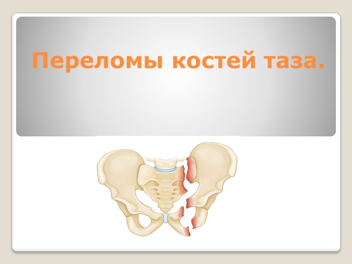 Презентация по анатомии и физиологии человека по теме:"Переломы костей таза." - Скачать школьные презентации PowerPoint бесплатно | Портал бесплатных презентаций school-present.com