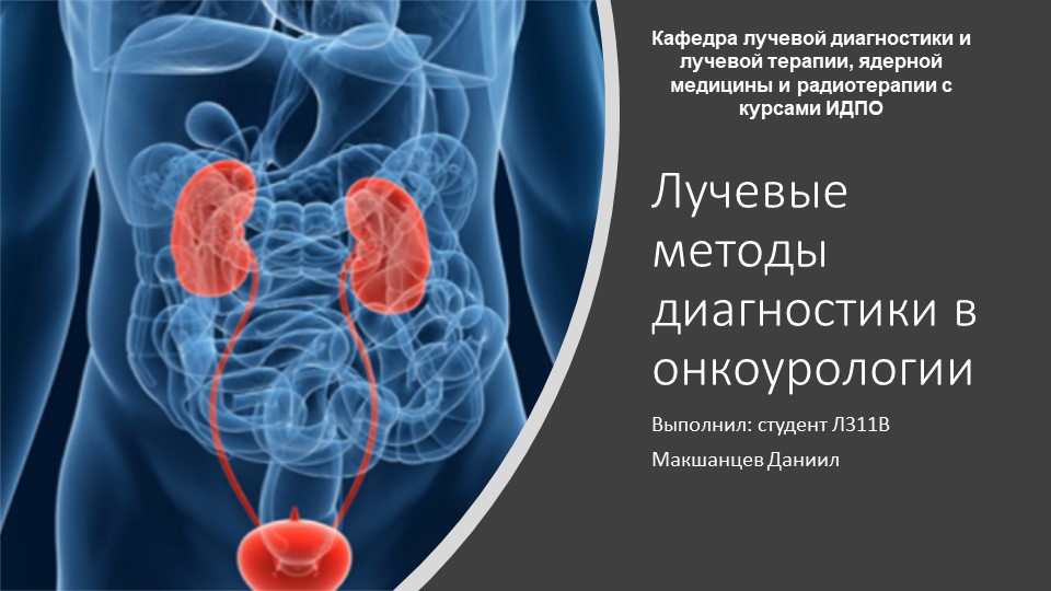 Презентация на тему: "Лучевая диагностика в онкоурологии" - Скачать школьные презентации PowerPoint бесплатно | Портал бесплатных презентаций school-present.com